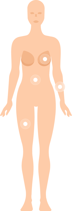 Body Illustration